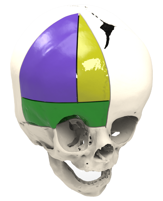 Cranial Reconstruction