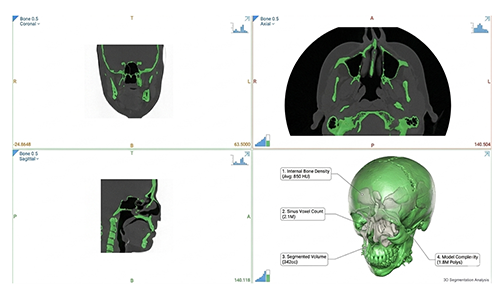 CureTech | Custom Patient-Specific CMF Implants & VSP